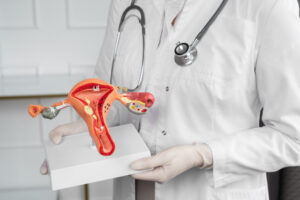 Fibroid rahim