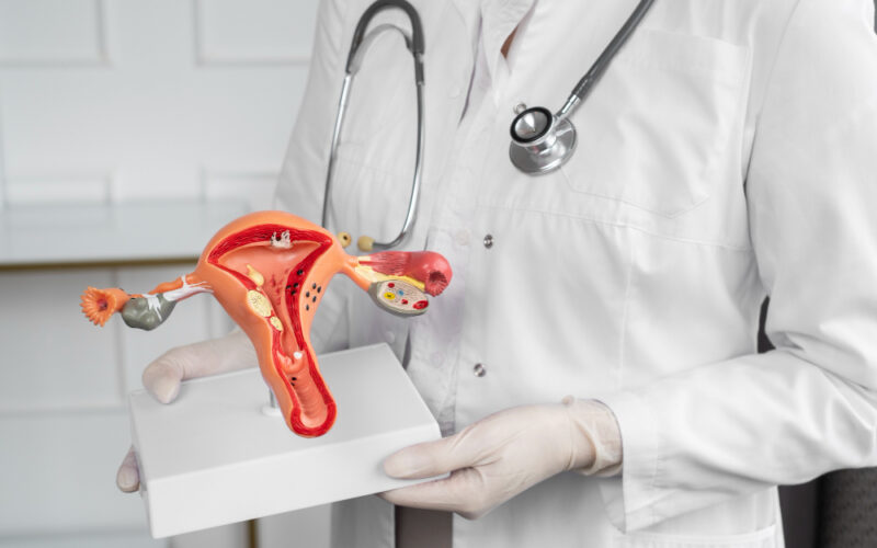 Fibroid rahim